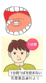 舌下1