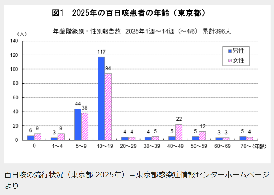 百日咳2025